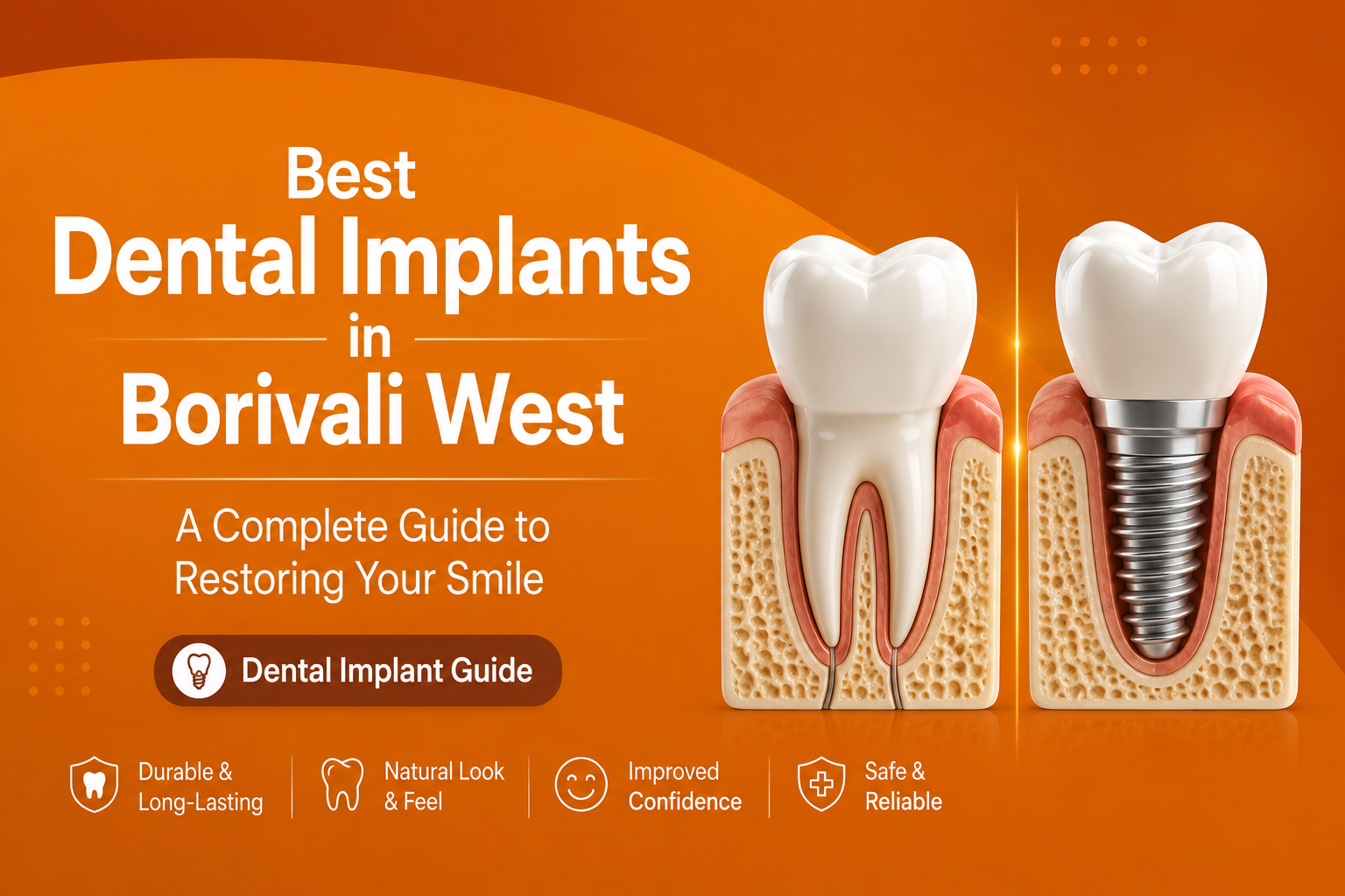 Best Dental Implants in Borivali West: A Complete Guide to Restoring Your Smile in 2026