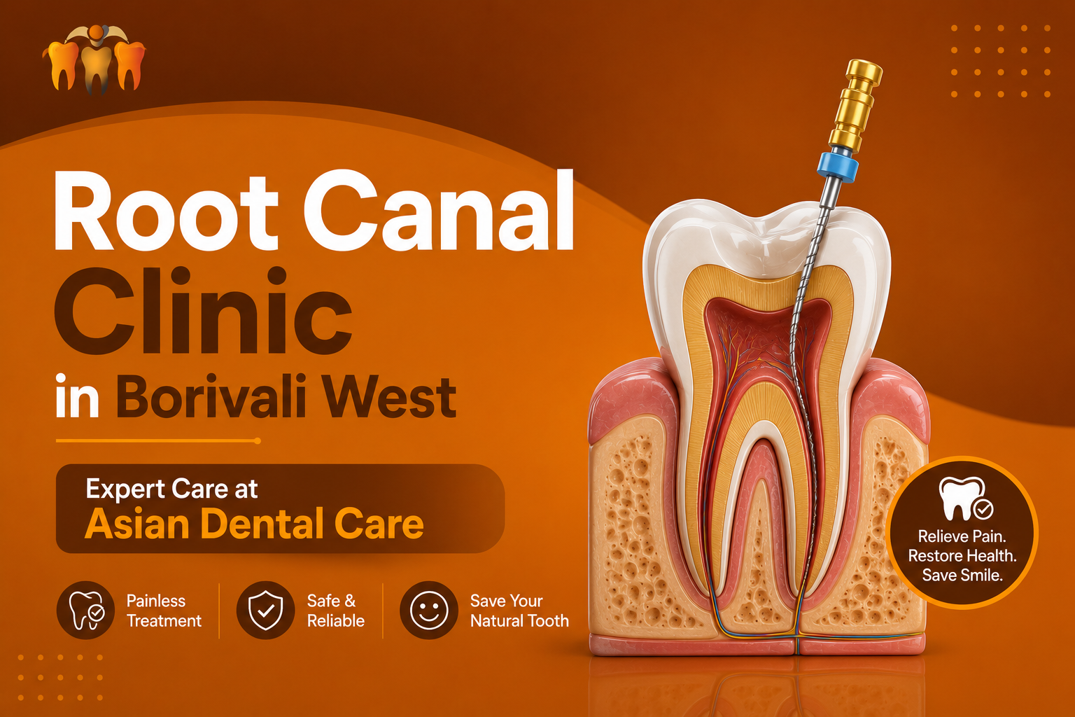 Root Canal Clinic in Borivali West – Expert Care at Asian Dental Care